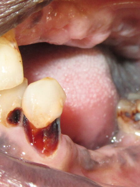 full mouth implant 3